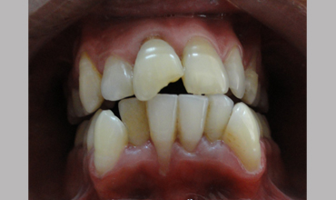 Dental care in Anand
                    